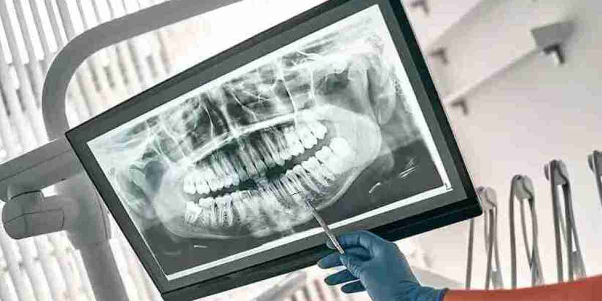 Digital Dental X-ray Market 2023 | Industry Demand, Fastest Growth, Opportunities Analysis and Forecast To 2032