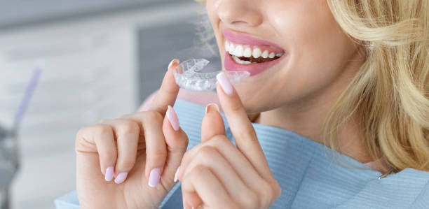Maintaining Oral Hygiene with Invisalign