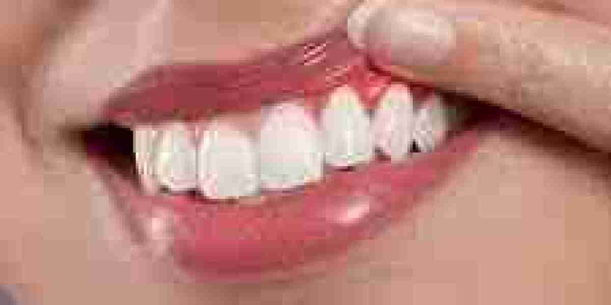 Laser Gum Replacement Procedure in Dubai: A Modern Approach to Dental Wellness