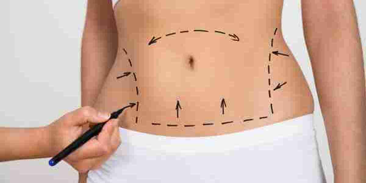 THE TRUTH BEHIND THESE LIPOSUCTION MYTHS