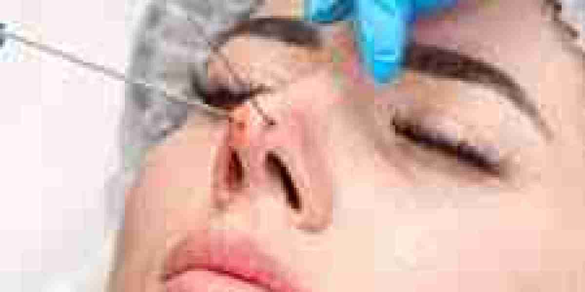 Rhinoplasty in Dubai: Redefining Beauty in the City of Dreams