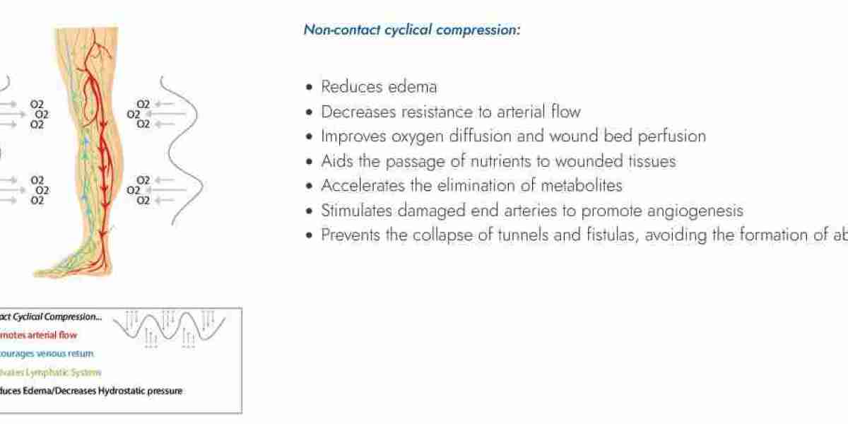 Understanding Chronic Wounds, Non-Healing Wounds, and Pressure Ulcer Care!