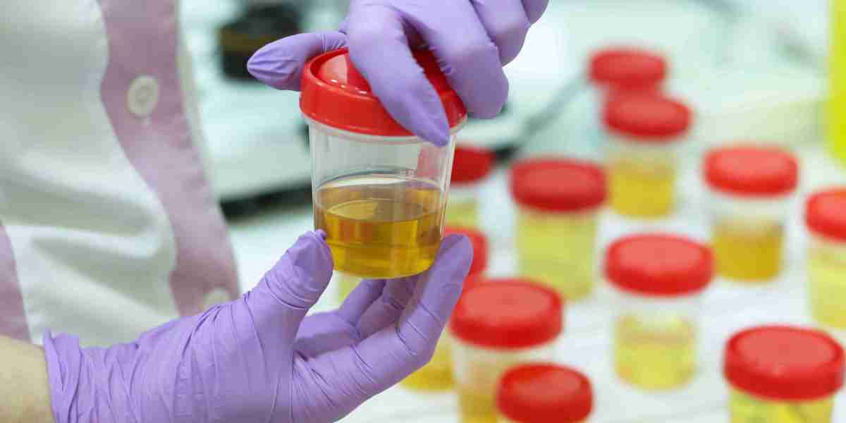 Global Urinalysis Market, Product Research, Market Information, Market Trends and Swot Analysis 2024-2031