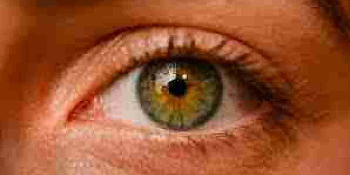 Ophthalmic Disease Therapeutics Market To Witness Huge Growth By 2032