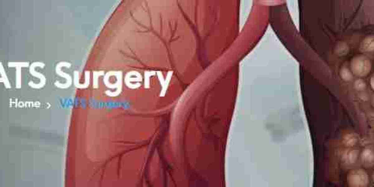 Video Assisted Thoracic Surgery or VATS Surgery in Gurgaon