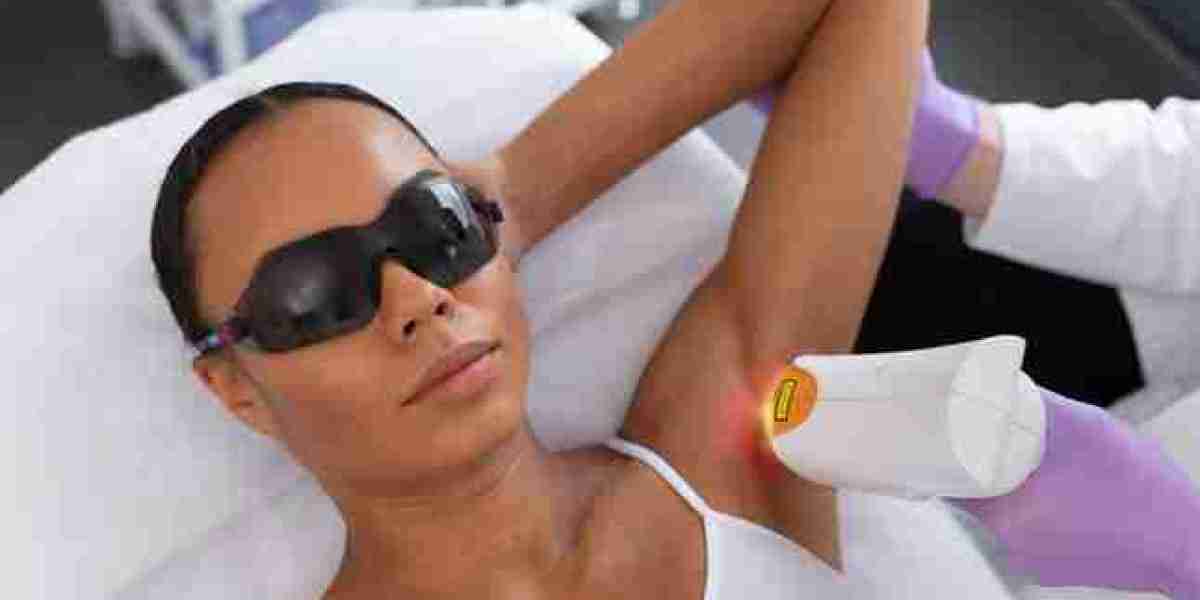 Black London Laser Hair Removal: Achieving Smooth, Flawless Skin