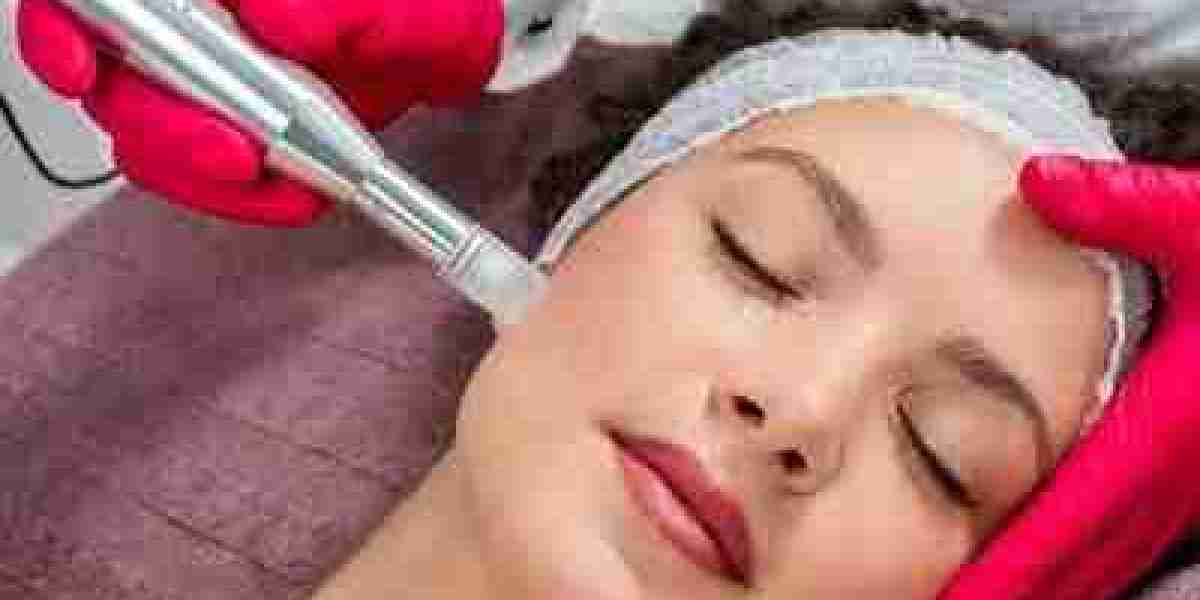 Microneedling vs. Traditional Anti-Aging Treatments