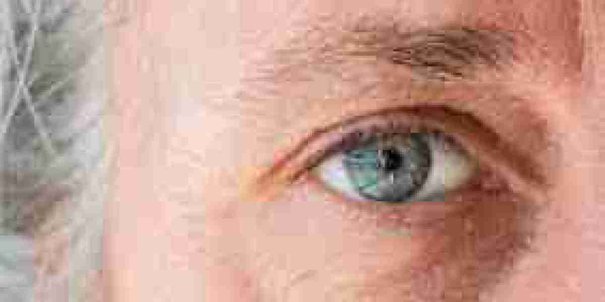 Corneal Edema Treatment Market Size, Outlook Research Report 2023-2032