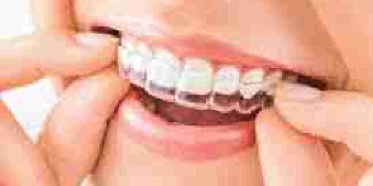 India Clear Aligners Market looks to expand its size in Overseas Market