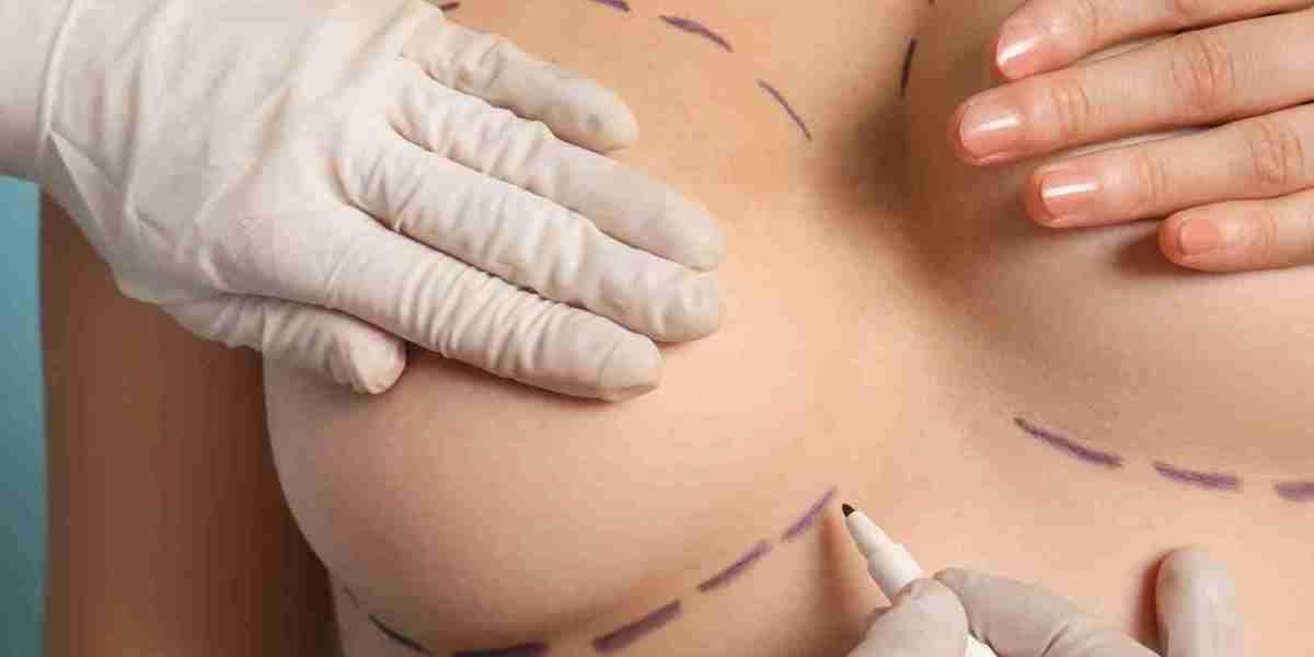 Addressing Scarring Concerns After Breast Fat Transfer