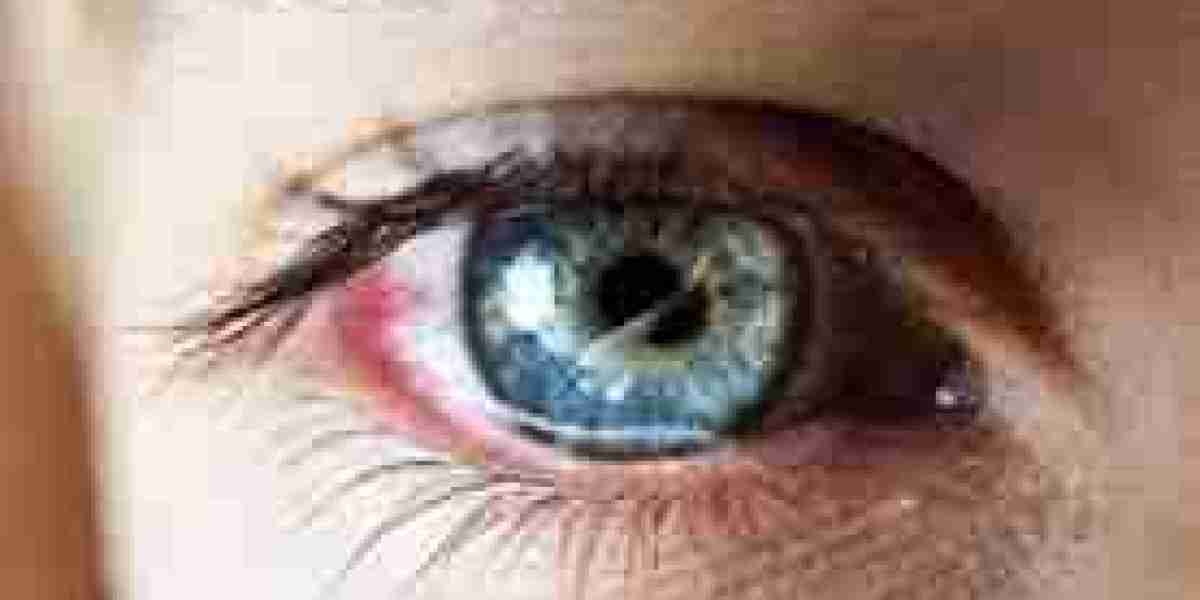Ocular Trauma Devices Market: Ready To Fly on high Growth Trends