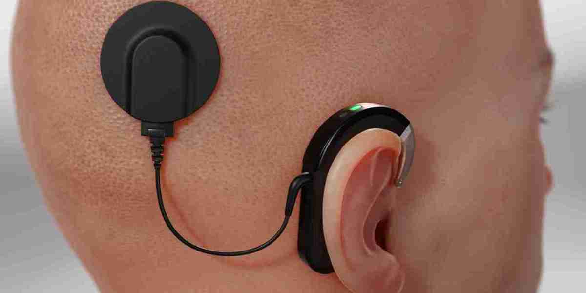 Hearing Implant Market Size, Growth & Industry Analysis Report, 2032