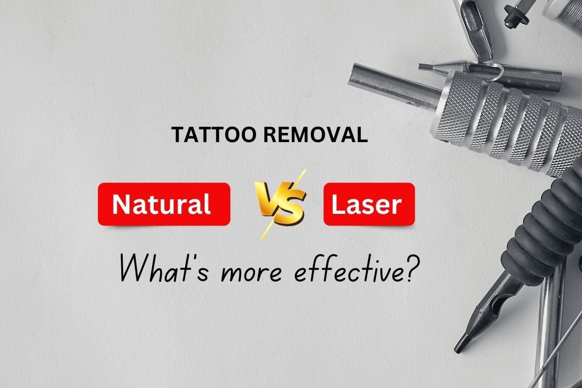 Natural Tattoo Removal vs. Laser: What’s More Effective? | 3Cube Tattoo Studio