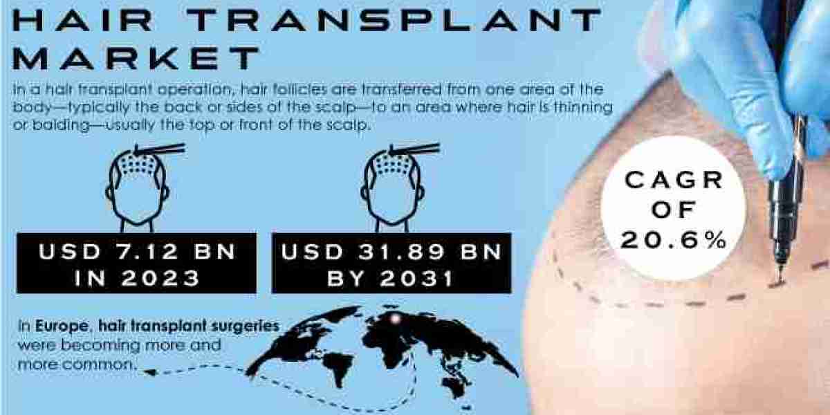 Hair Transplant Market Size and Its Competitive Landscape