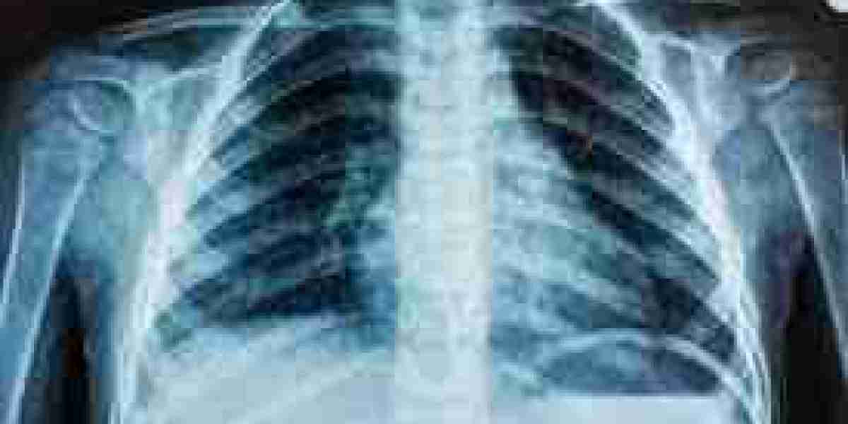 Medical X-ray Market Key Segments to Play Solid Role In A Booming Industry