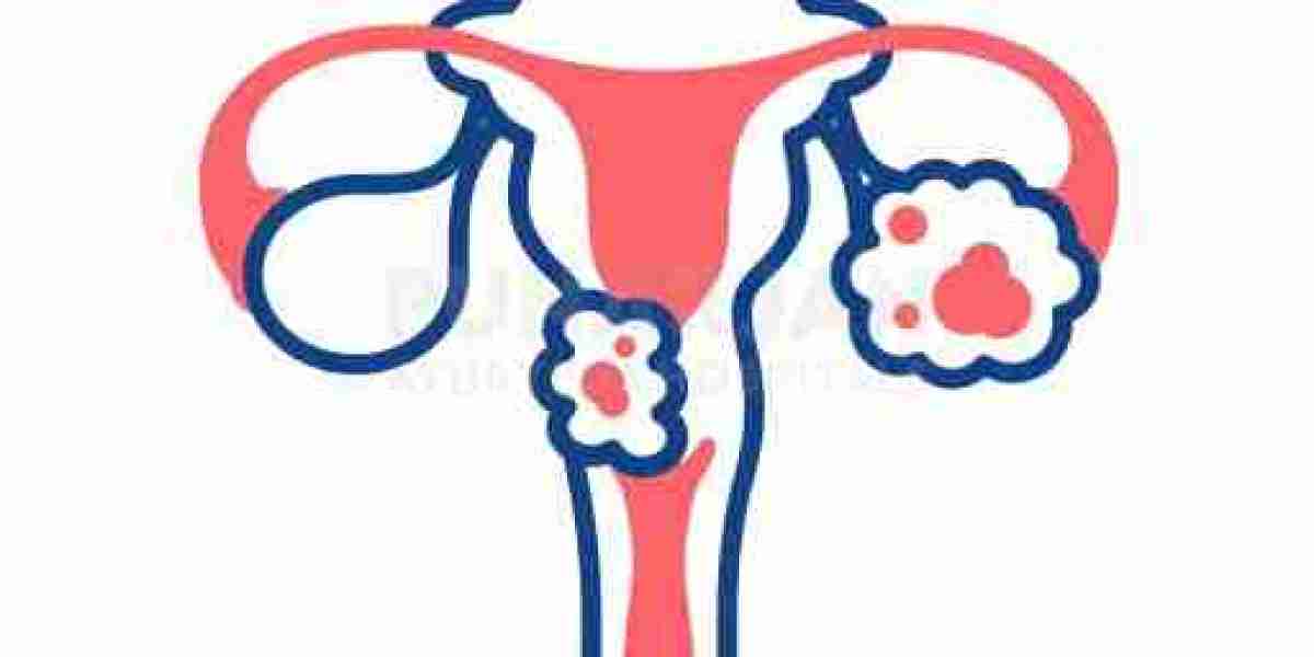 Best Cervical Cancer Treatment Hospitals in Bangalore