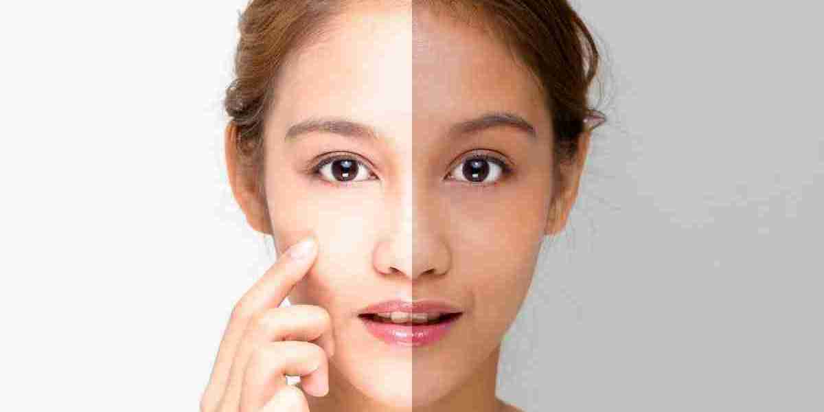 Comparing Skin Whitening Methods: Dubai's Expert Opinions