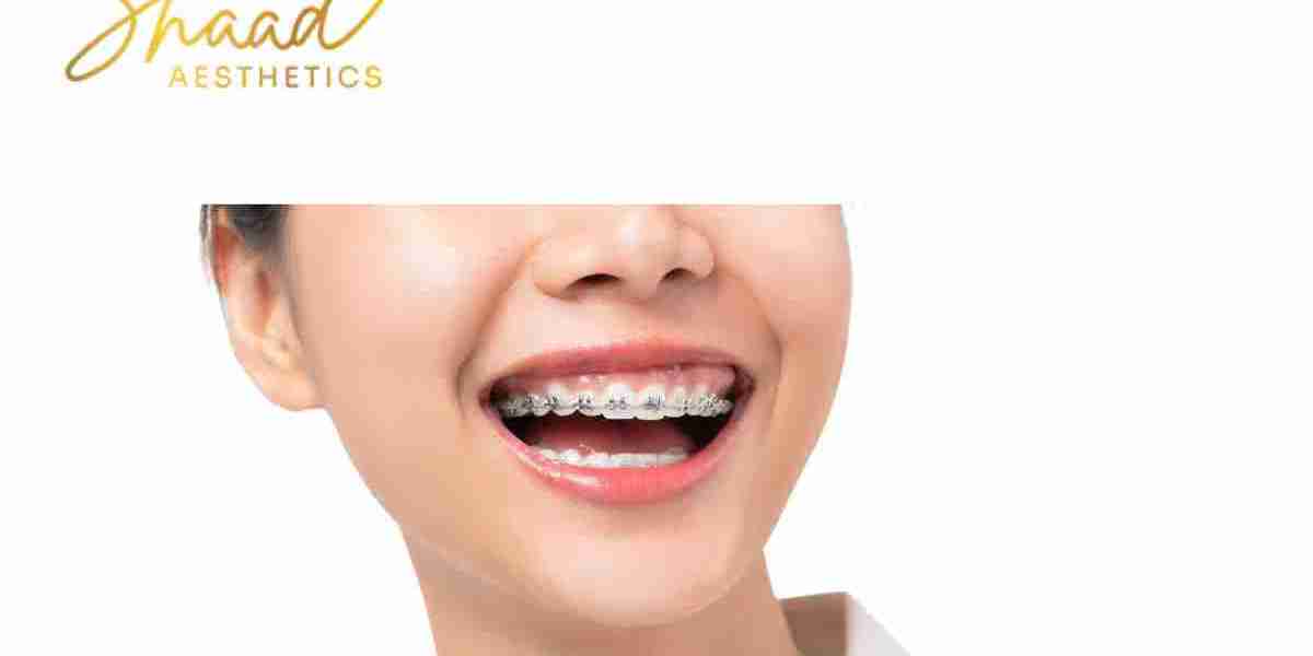 Experience Top Dental clinic in Coimbatore at Shaad Aesthetics