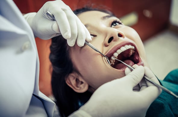 Dental Fillings