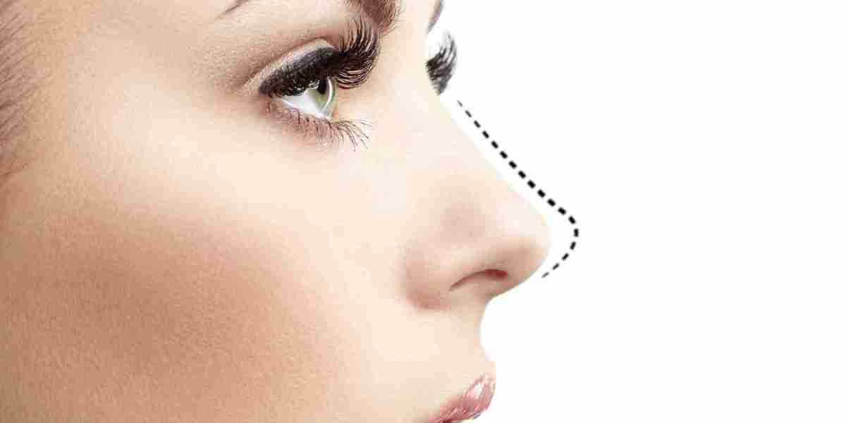 Rhinoplasty for Men: Trends and Insights from Dubai