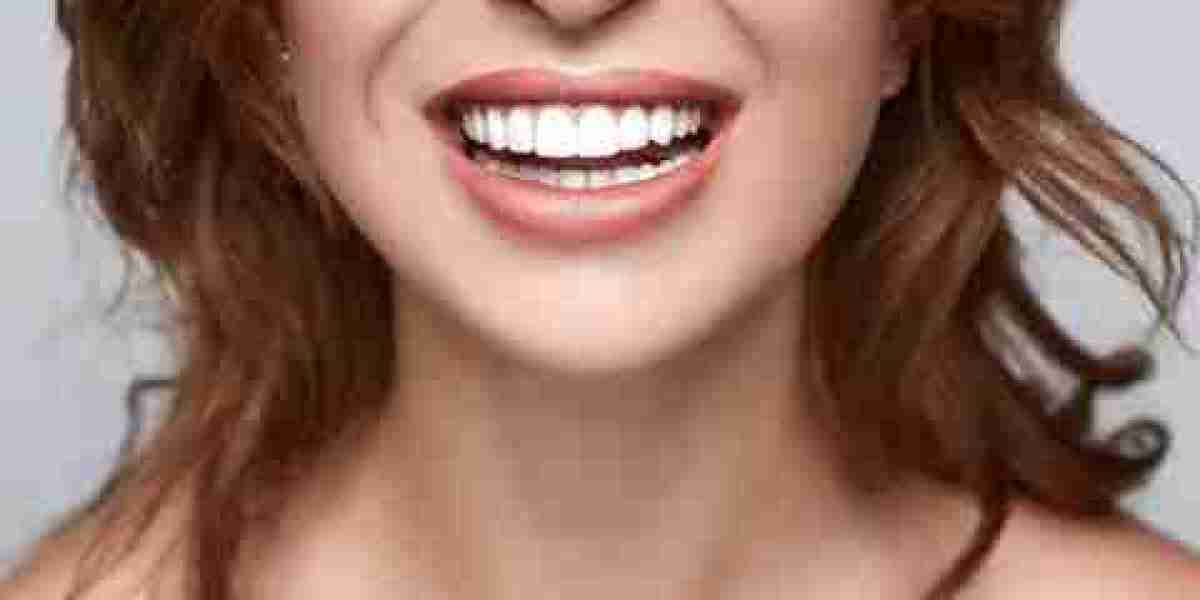 Transform Your Smile with Dubai’s Leading Teeth Whitening Solutions