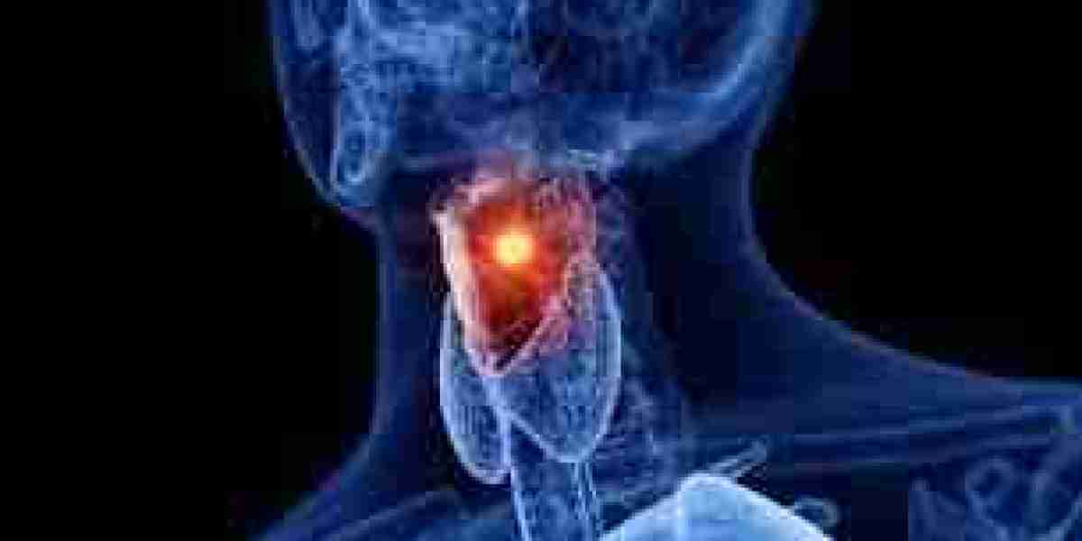 Laryngeal Mask Market: Comprehensive study explores Huge Growth in Future