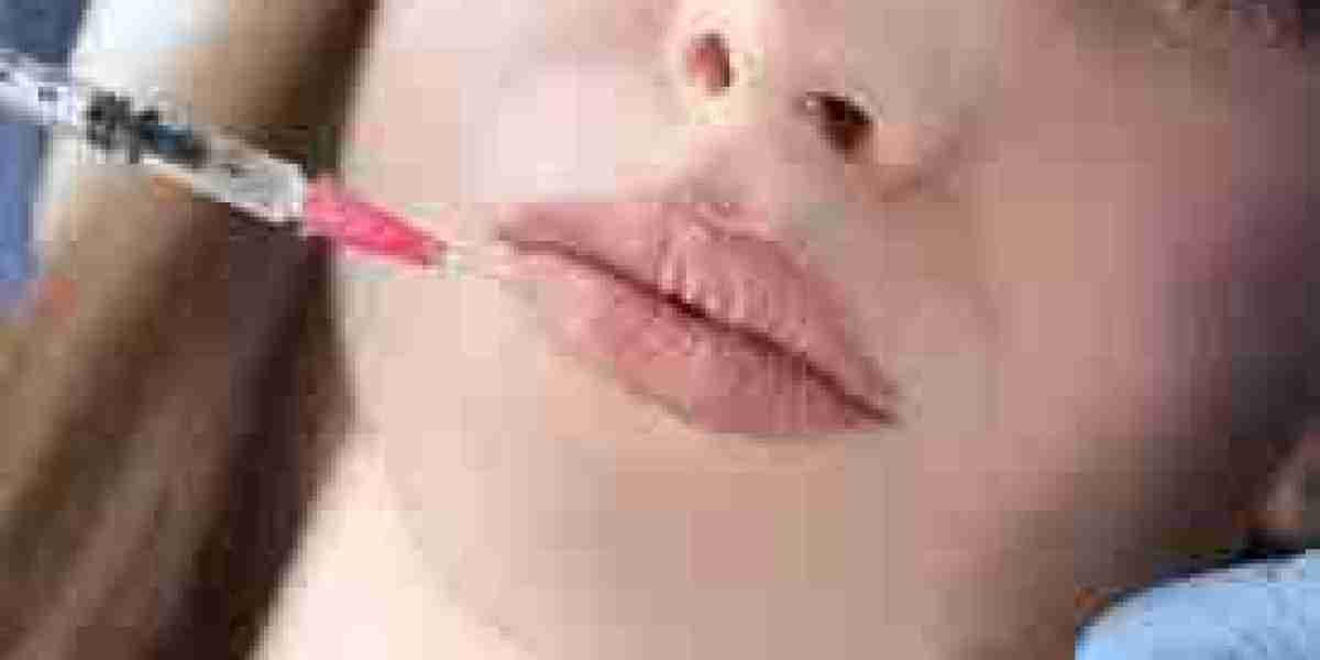 Everything You Need to Know About Getting Russian Lip Fillers in Riyadh