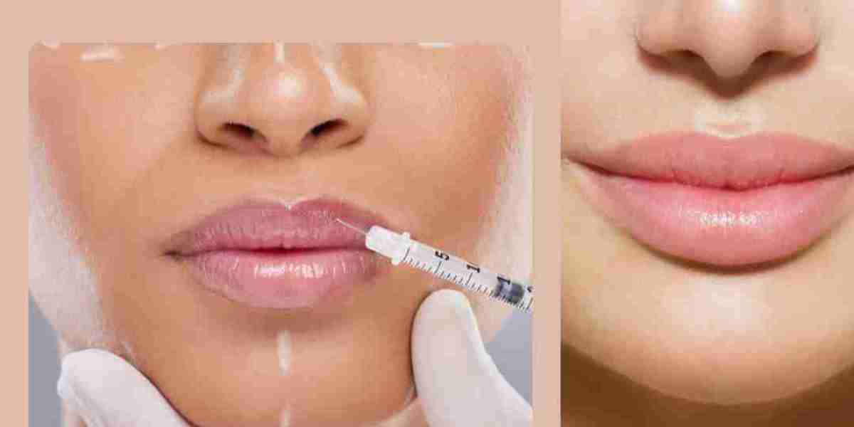 Enhance Your Beauty with Lip Filler in Delhi: Dr. Neha Batra’s Expertise