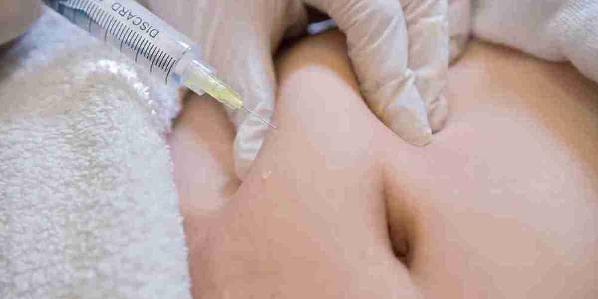 The Latest Trends in Fat Dissolving Needles in Dubai for 2024