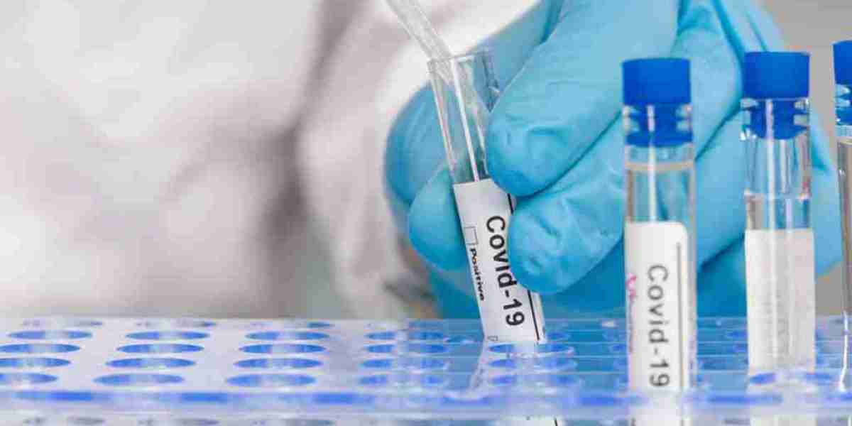 Global COVID-19 Diagnostic Market Report 2023 to 2032