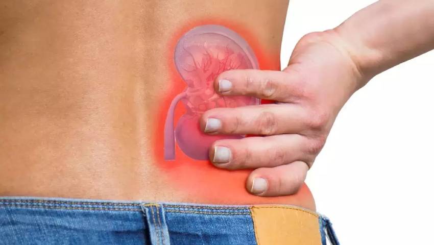 RIRS Treatment for Kidney Stone - Apex Multispeciality Hospital Kalewadi