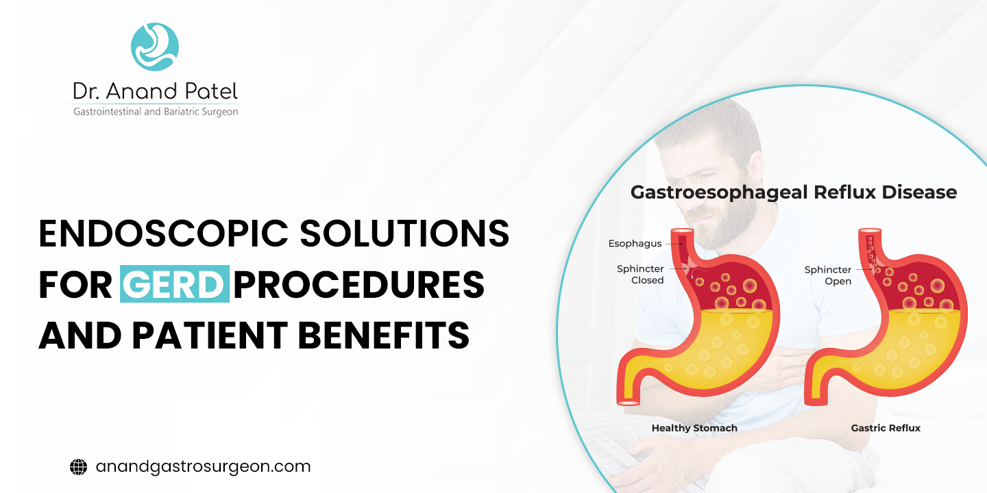 Endoscopic solutions for GERD by Best gastro surgeon in Ahmedabad