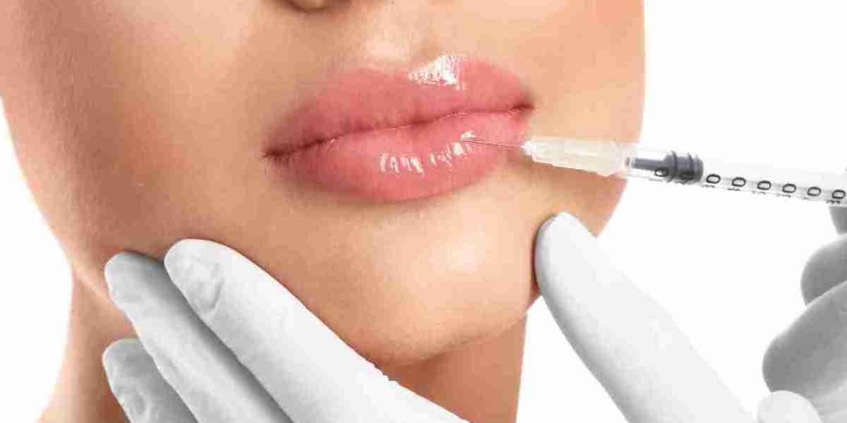 The Secret to Perfect Lips: Lip Filler Calgary Services