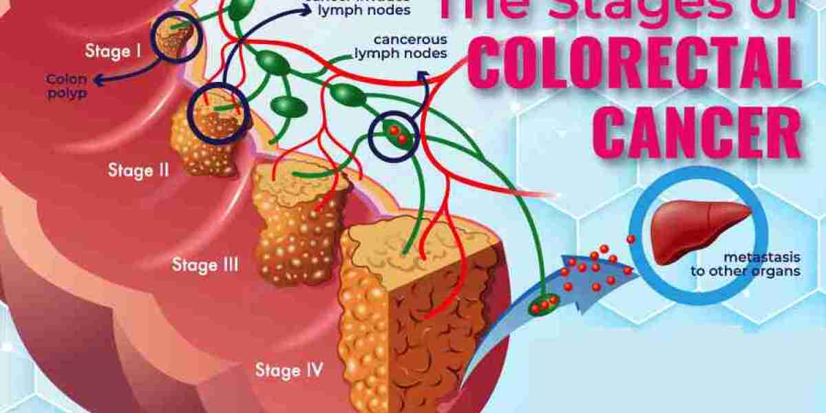 Panitumumab Market Analysis, Trends and Dynamic Demand by Forecast 2024 to 2034