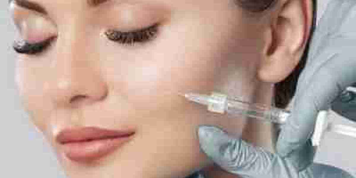 Dermal Fillers for Under-Eye Circles: Is It a Good Option?