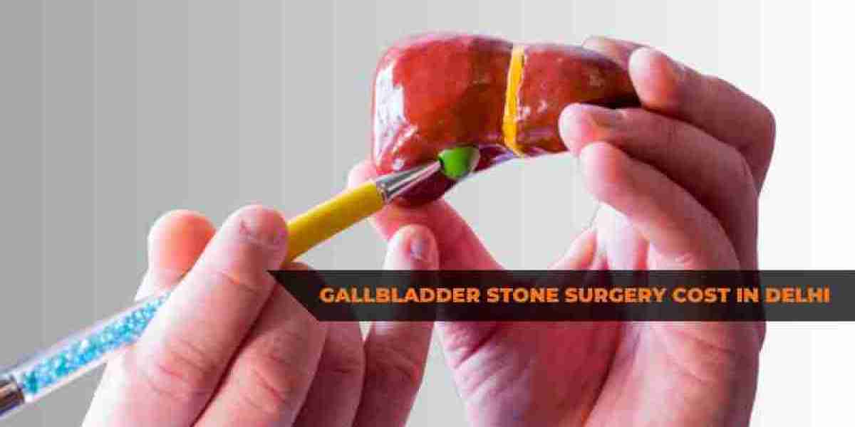 What is the Treatment for Gallbladder Stones