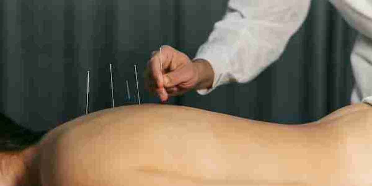 The Essential Benefits of Choosing the Right Acupuncture Clinic