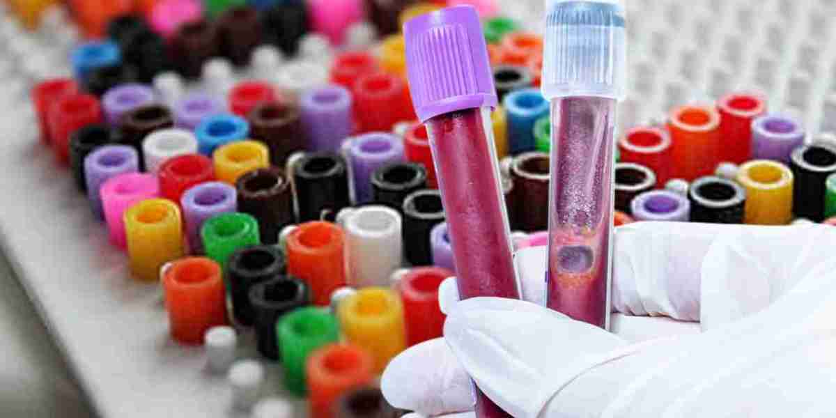 Blood Collection Tubes Market Expands with Growing Focus on Early Disease Detection