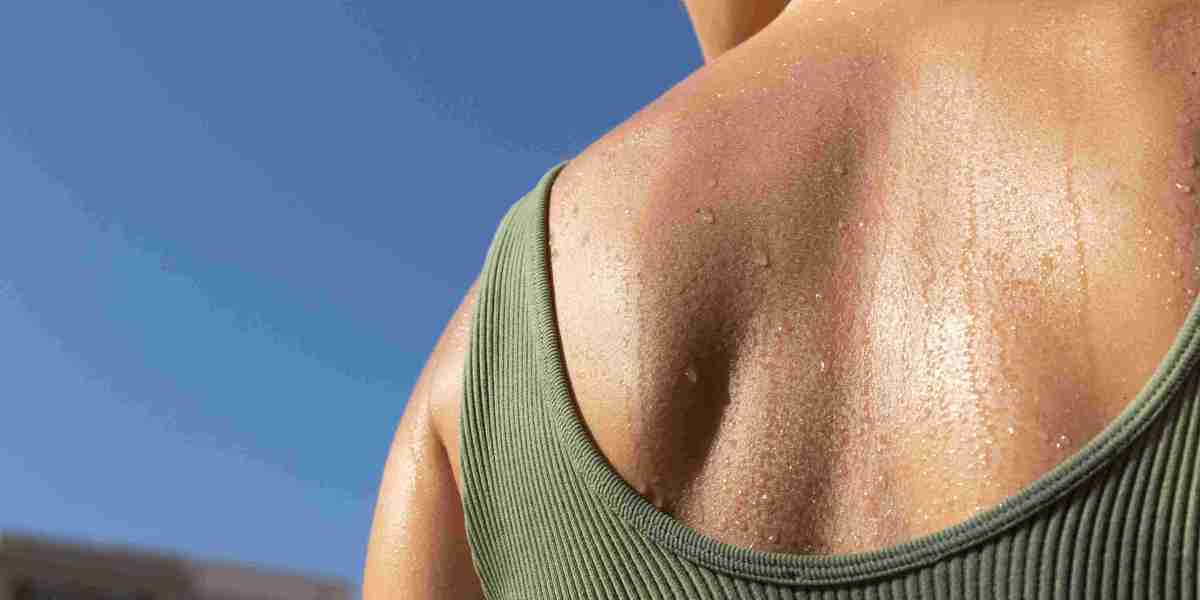 Treatment of sweat patches in a clinic – A General Overview