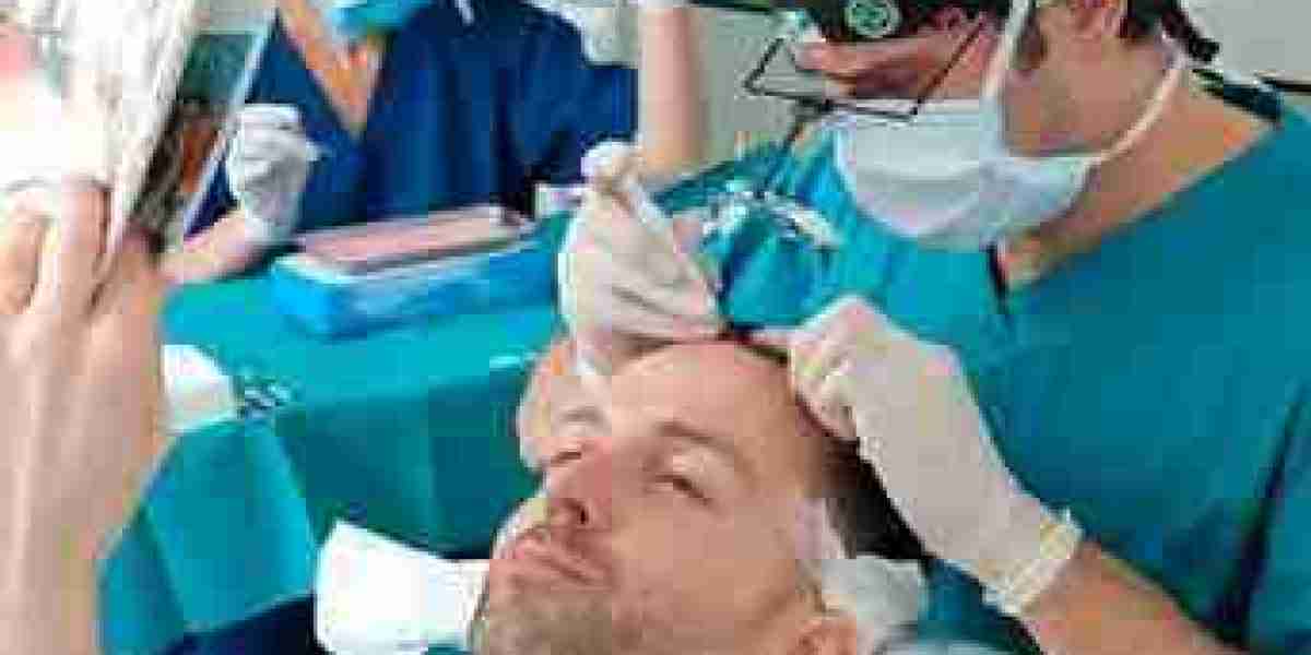 Understanding the Hair Transplant Procedure in Abu Dhabi