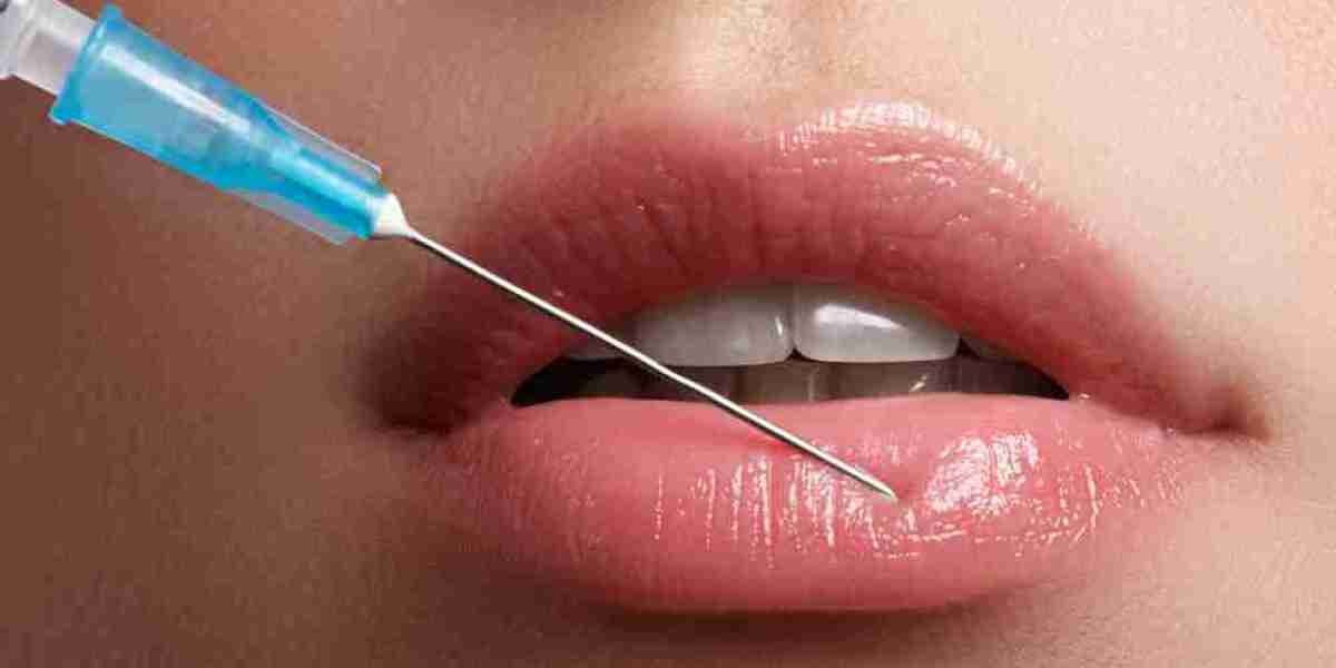 The Ultimate Guide to Lip Filler Injections in Dubai: What You Need to Know