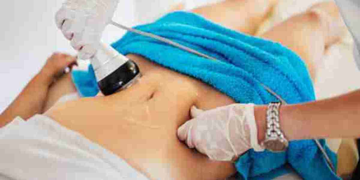 Get Flawless Results with Laser Liposuction in Dubai