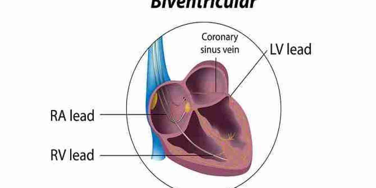 Why Do We Use Biventricular Recoordination Battery, and How Is It Helpful for Mankind?