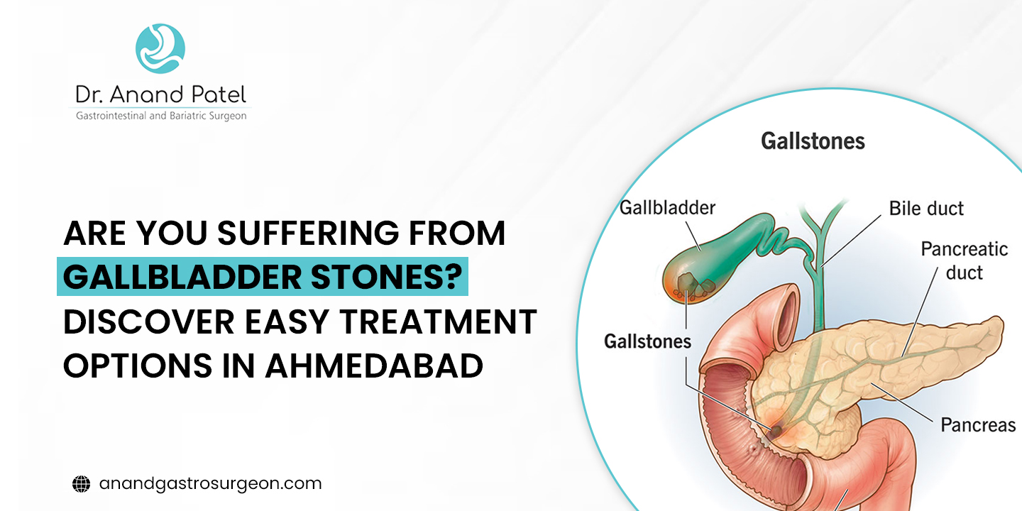 A complete guide on gallbladder stones and treatment options