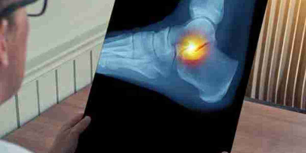 Expert Care for Ankle Bone Fractures at Ortho Center, Lahore