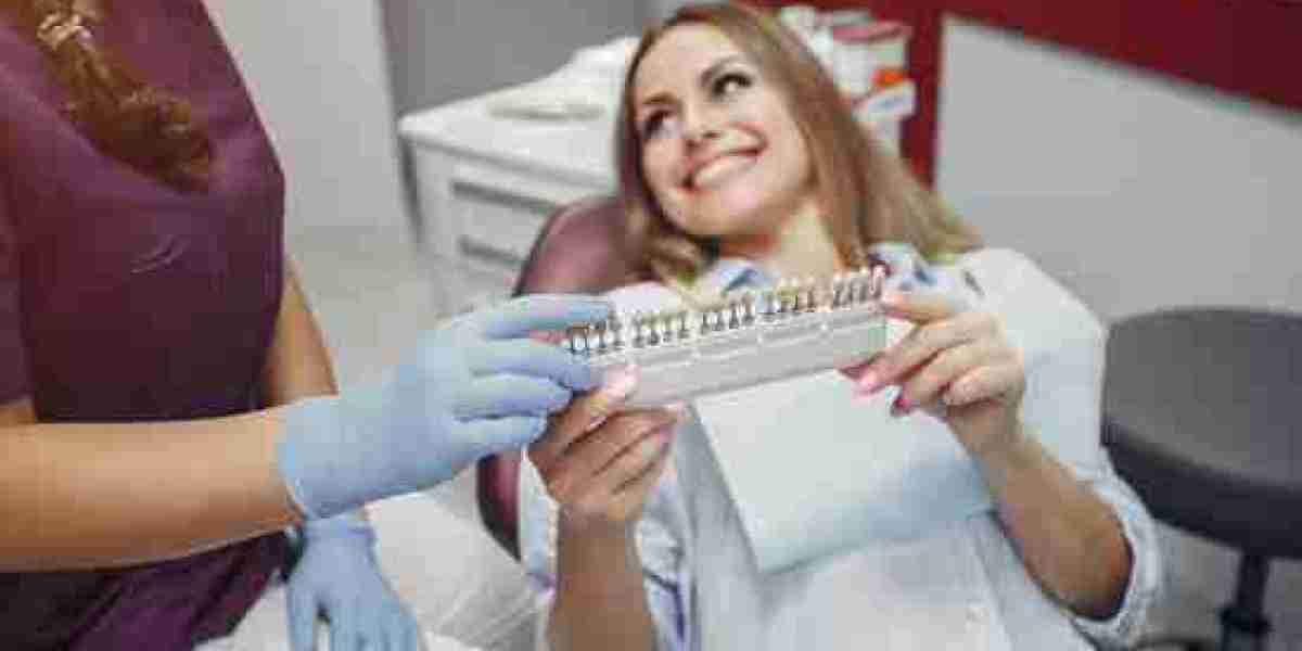 Why Dental Veneers in Birmingham Are Worth the Investment