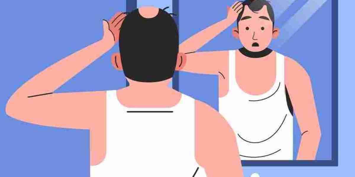 A New Lease on Life: How Hair Transplants Can Change Your Look and Outlook