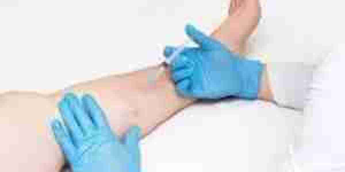 Does Insurance Cover Vein Treatment in NYC? What You Should Know