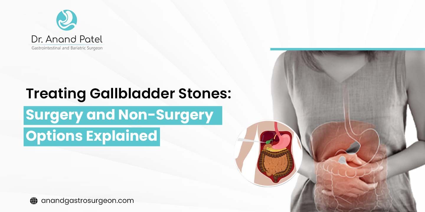 Gallbladder stone treatment: Surgery vs. Non-Surgery