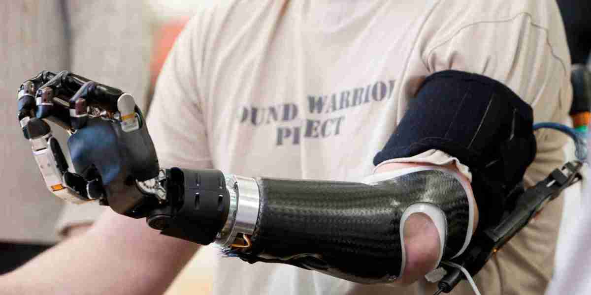 Artificial Limbs Market: Recent Developments in Customization and Accessibility